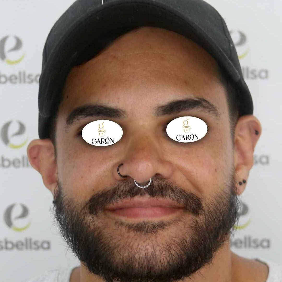 2 después (1)