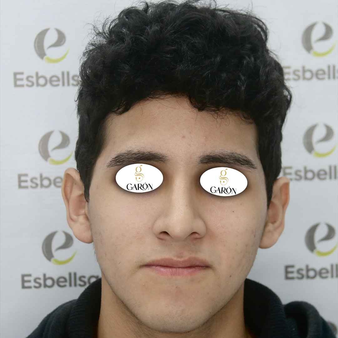 3 después
