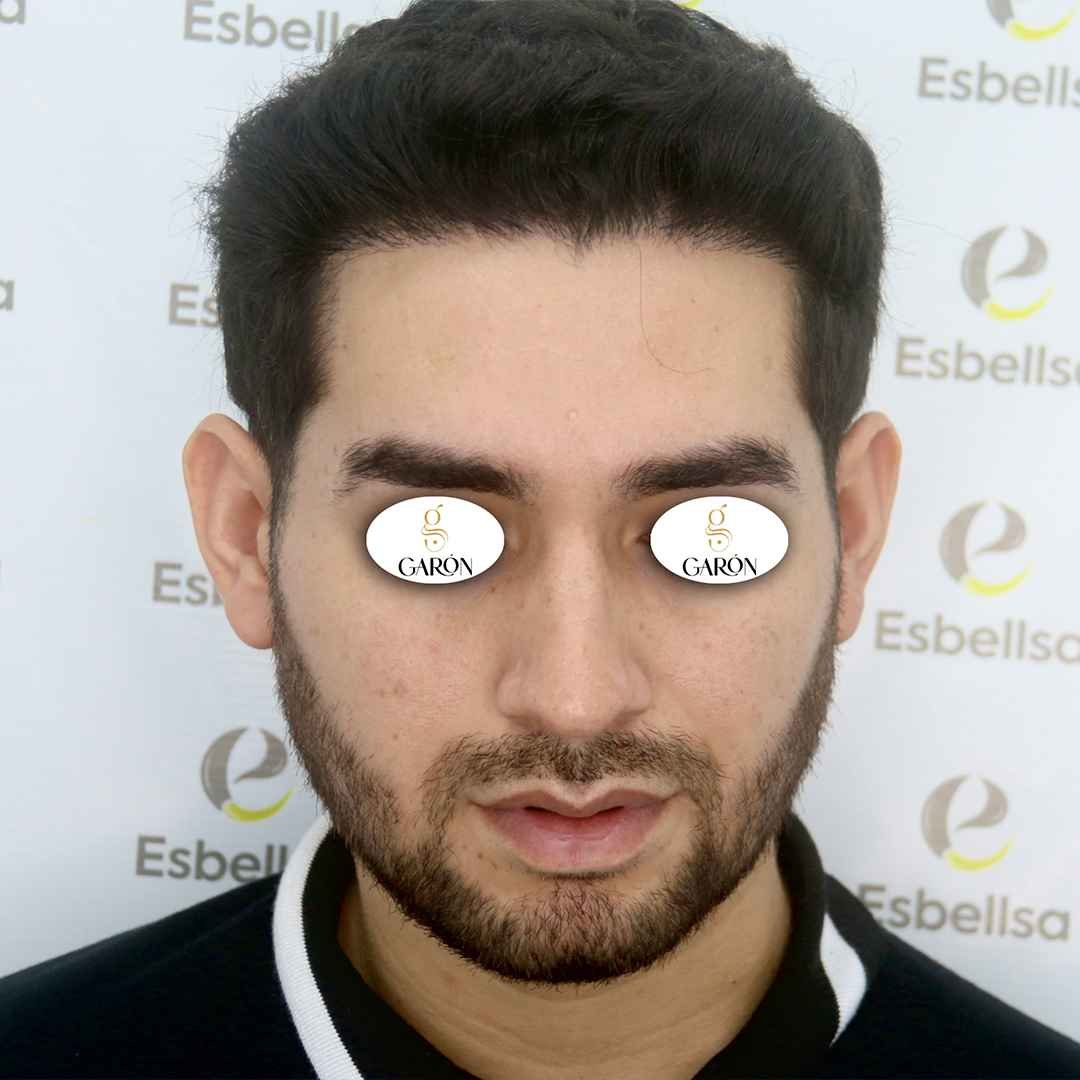 3 después_ (1)