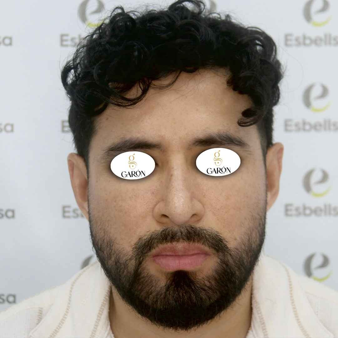 4 después_